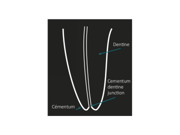 20180206apex display enlocapex 6ionyx