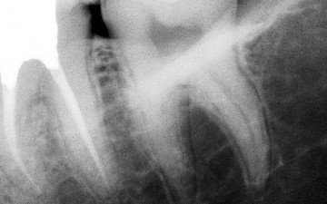 One curve dr khaled balto x ray 1