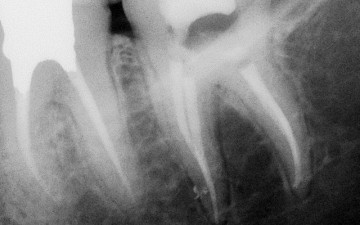 One curve dr khaled balto x ray 2