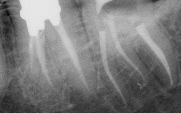 One curve dr khaled balto x ray 3