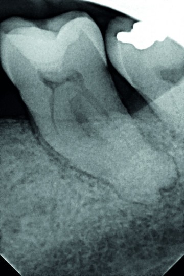 One curve dr tara mcmahon x ray 1 1