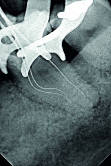 One curve dr tara mcmahon x ray 2 2