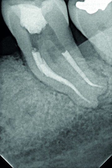 One curve dr tara mcmahon x ray 3 1